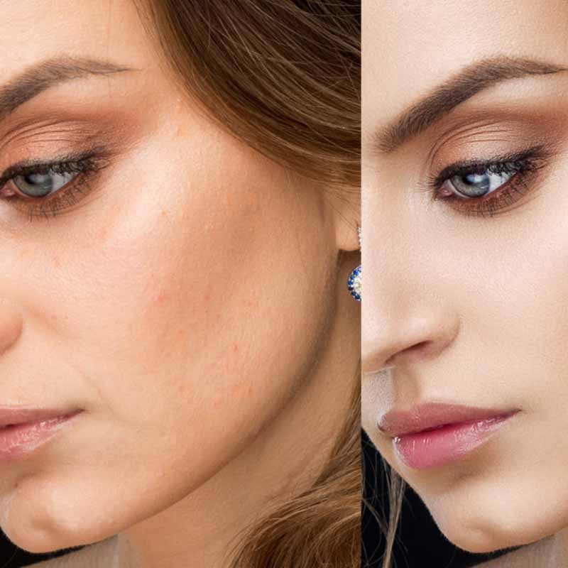 Retouching Photos – The New Rules